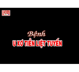 Bệnh U xơ tiền liệt tuyến
